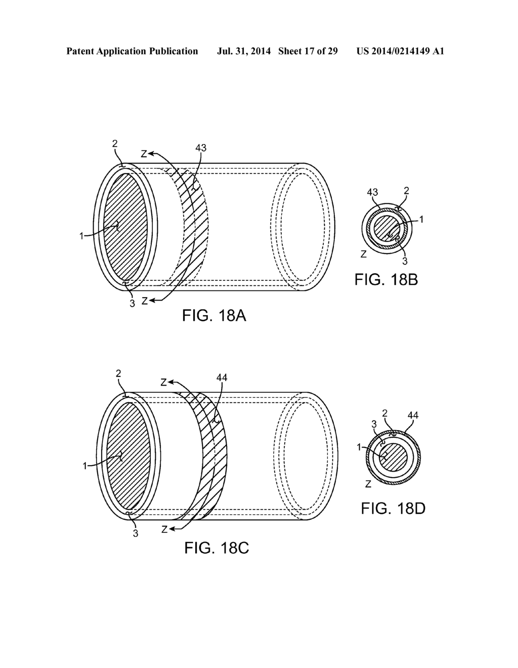 METHOD AND APPARATUS FOR MEASURING FLOW THROUGH A LUMEN - diagram, schematic, and image 18