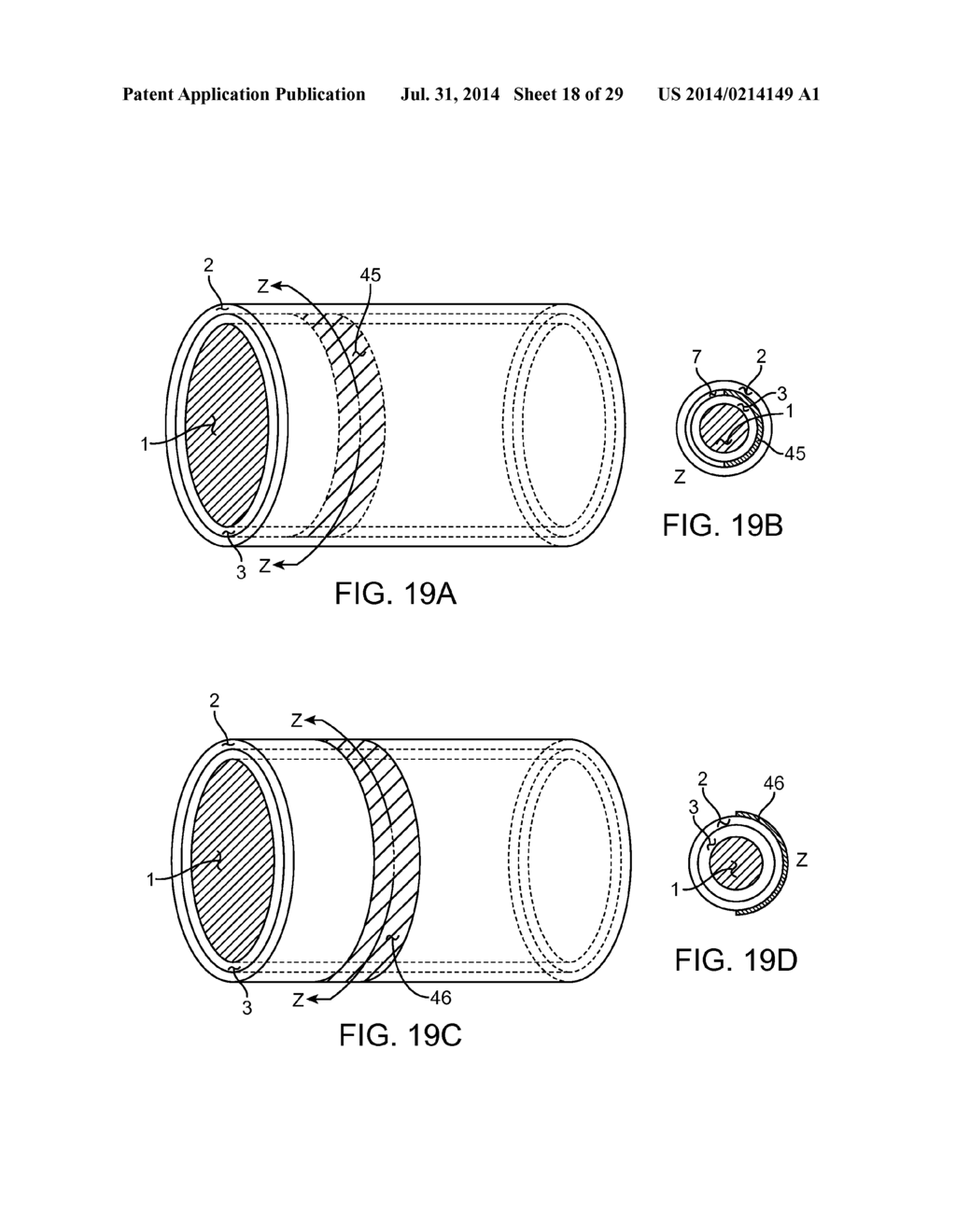 METHOD AND APPARATUS FOR MEASURING FLOW THROUGH A LUMEN - diagram, schematic, and image 19