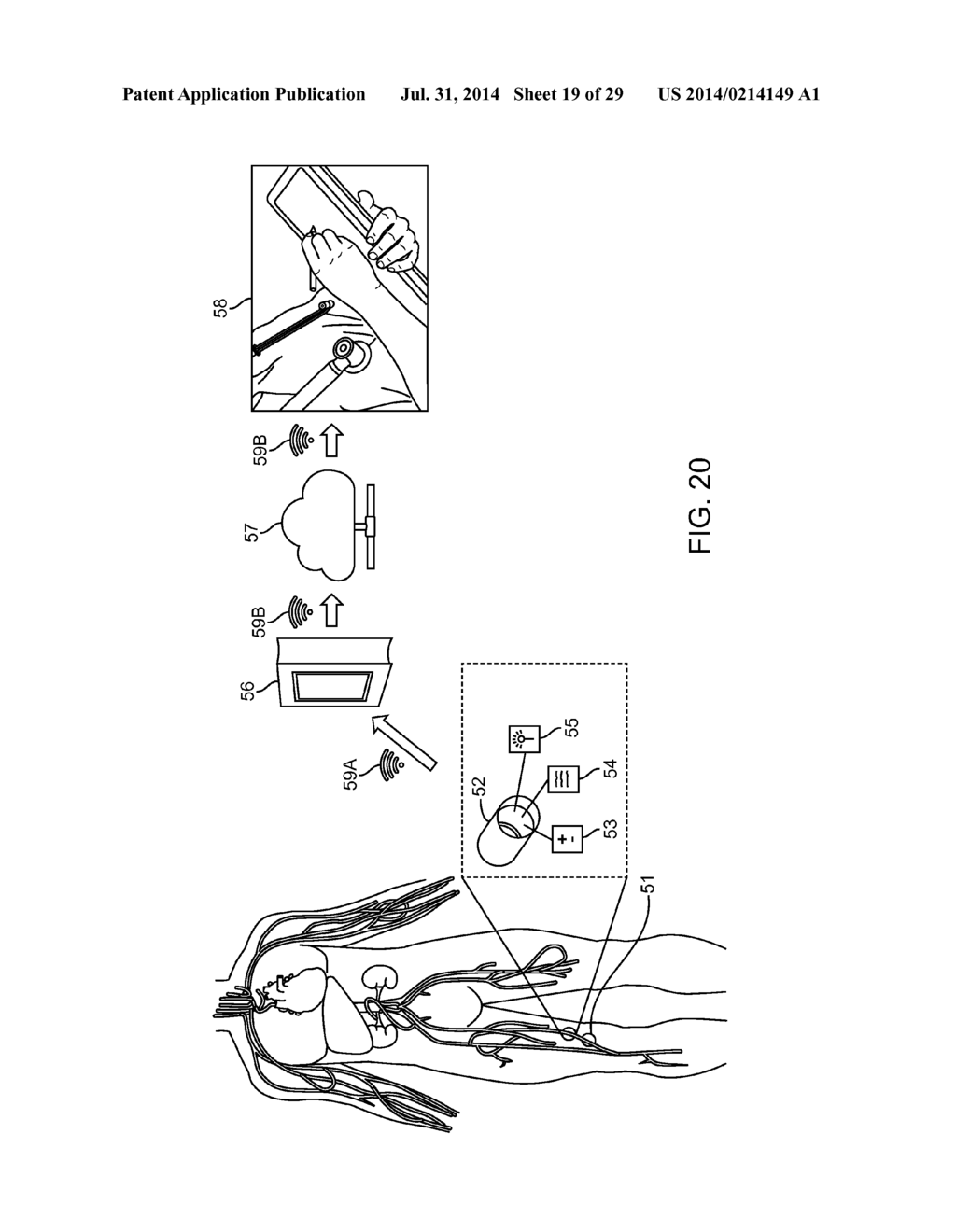 METHOD AND APPARATUS FOR MEASURING FLOW THROUGH A LUMEN - diagram, schematic, and image 20