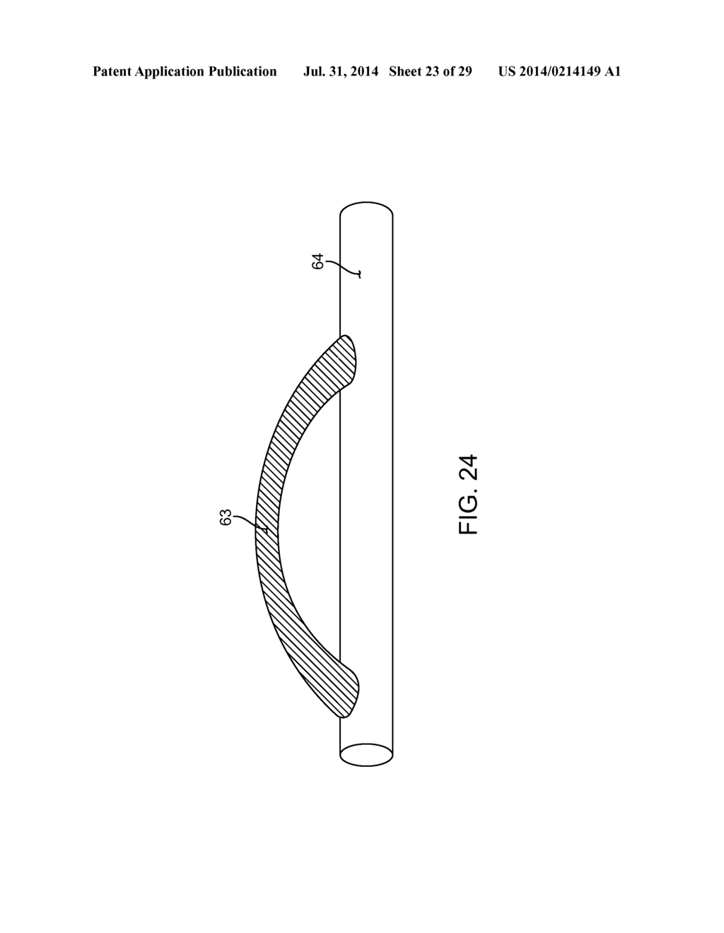 METHOD AND APPARATUS FOR MEASURING FLOW THROUGH A LUMEN - diagram, schematic, and image 24