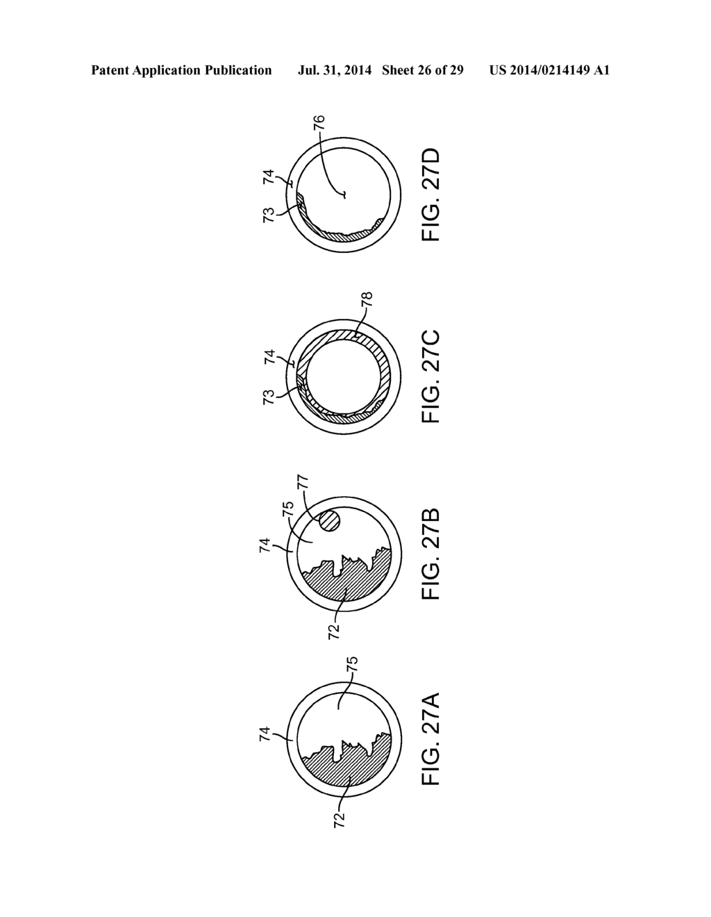 METHOD AND APPARATUS FOR MEASURING FLOW THROUGH A LUMEN - diagram, schematic, and image 27