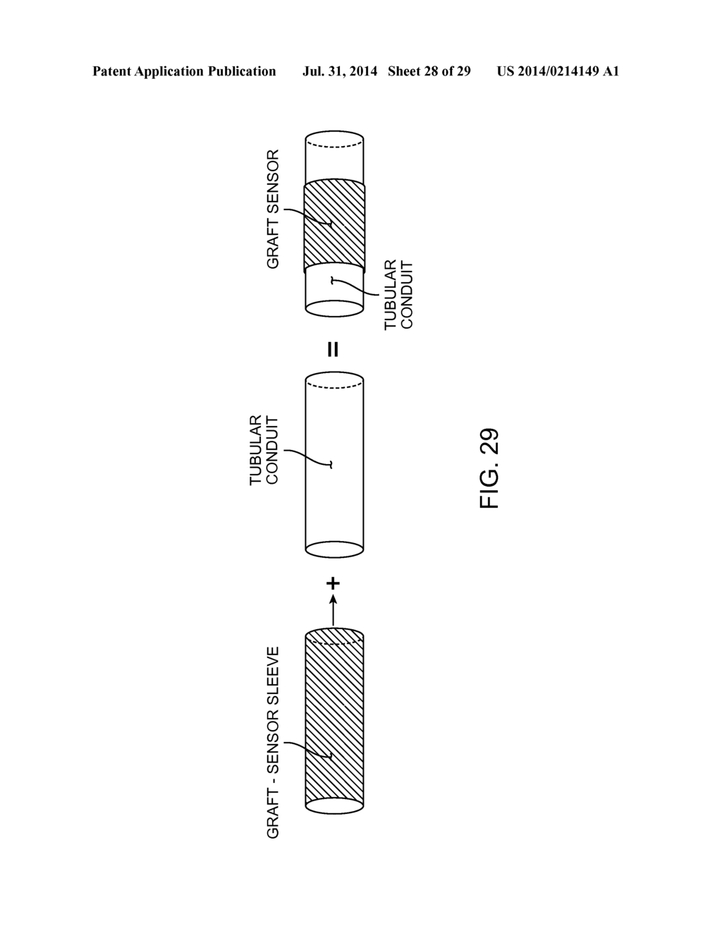 METHOD AND APPARATUS FOR MEASURING FLOW THROUGH A LUMEN - diagram, schematic, and image 29