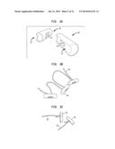 METHOD AND DEVICE FOR HEART VALVE REPAIR diagram and image