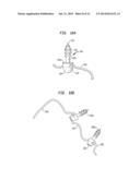 METHOD AND DEVICE FOR HEART VALVE REPAIR diagram and image