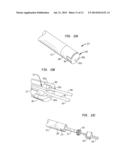 METHOD AND DEVICE FOR HEART VALVE REPAIR diagram and image