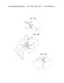 METHOD AND DEVICE FOR HEART VALVE REPAIR diagram and image