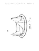 SURGICAL HEART VALVE FLEXIBLE STENT FRAME STIFFENER diagram and image