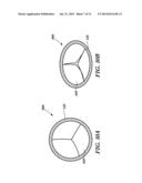 SURGICAL HEART VALVE FLEXIBLE STENT FRAME STIFFENER diagram and image