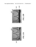 SURGICAL HEART VALVE FLEXIBLE STENT FRAME STIFFENER diagram and image