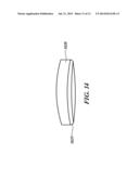 SURGICAL HEART VALVE FLEXIBLE STENT FRAME STIFFENER diagram and image