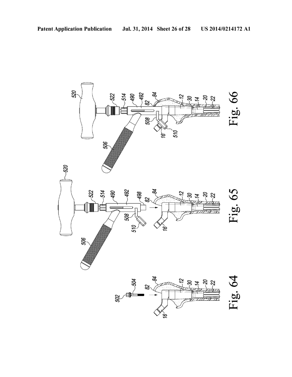 REVISION HIP PROSTHESIS HAVING AN IMPLANTABLE DISTAL STEM COMPONENT - diagram, schematic, and image 27