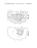 WEAR ASSEMBLY diagram and image