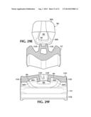 WEAR ASSEMBLY diagram and image