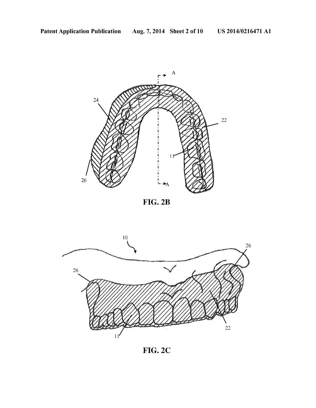 INTRA-ORAL APPLIANCE AND METHODS OF USING SAME - diagram, schematic, and image 03