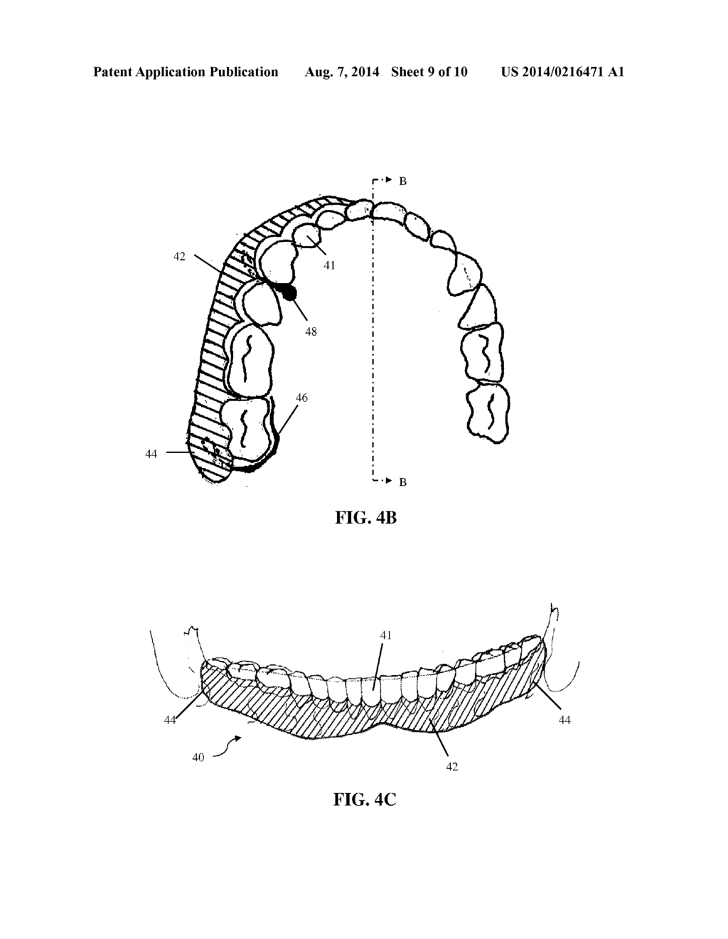 INTRA-ORAL APPLIANCE AND METHODS OF USING SAME - diagram, schematic, and image 10