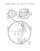 Inflation Work Station diagram and image