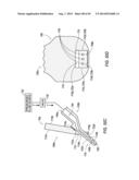 Inflation Work Station diagram and image