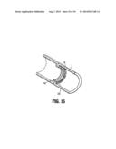 Buttress Attachment for Circular Stapling Device diagram and image