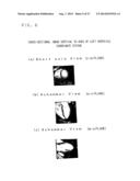 MEDICAL IMAGE PROCESSING APPARATUS AND METHOD THEREOF diagram and image