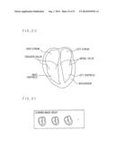 MEDICAL IMAGE PROCESSING APPARATUS AND METHOD THEREOF diagram and image