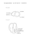 MEDICAL IMAGE PROCESSING APPARATUS AND METHOD THEREOF diagram and image