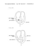 MEDICAL IMAGE PROCESSING APPARATUS AND METHOD THEREOF diagram and image