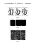 METHODS FOR INDUCING CARDIOMYOCYTE PROLIFERATION diagram and image