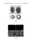 METHODS FOR INDUCING CARDIOMYOCYTE PROLIFERATION diagram and image