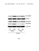 TREATMENT OF COLON CANCER USING COMPLEMENT INHIBITORS diagram and image