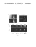 BIOMARKERS FOR EPITHELIAL CANCER DIAGNOSIS AND TREATMENT diagram and image