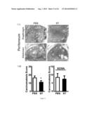 BIOMARKERS FOR EPITHELIAL CANCER DIAGNOSIS AND TREATMENT diagram and image