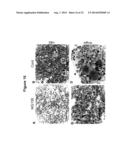 MICRORNA INHIBITION FOR THE TREATMENT OF INFLAMMATION AND     MYELOPROLIFERATIVE DISORDERS diagram and image