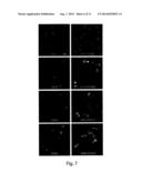 MICROVESICLES ISOLATED FROM MESENCHYMAL STEM CELLS FOR USE AS     IMMUNOSUPPRESSIVE AGENTS diagram and image