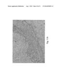 MICROVESICLES ISOLATED FROM MESENCHYMAL STEM CELLS FOR USE AS     IMMUNOSUPPRESSIVE AGENTS diagram and image