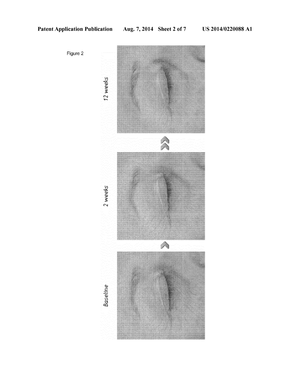 METHODS FOR THE PRODUCTION OF A COSMETIC COMPOSITION FROM HATCHING FLUID     AND USES THEREOF FOR IMPROVING THE COSMETIC APPEARANCE OF SKIN - diagram, schematic, and image 03