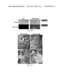 Compositions and Methods for Detecting, Treating, or Preventing Reductive     Stress diagram and image