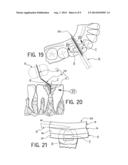 DENTAL SHAPING STRIP diagram and image