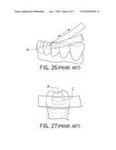 DENTAL SHAPING STRIP diagram and image