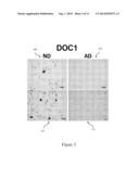 METHOD AND SYSTEM TO DETECT, DIAGNOSE, AND MONITOR THE PROGRESSION OF     ALZHEIMER S DISEASE diagram and image