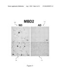 METHOD AND SYSTEM TO DETECT, DIAGNOSE, AND MONITOR THE PROGRESSION OF     ALZHEIMER S DISEASE diagram and image