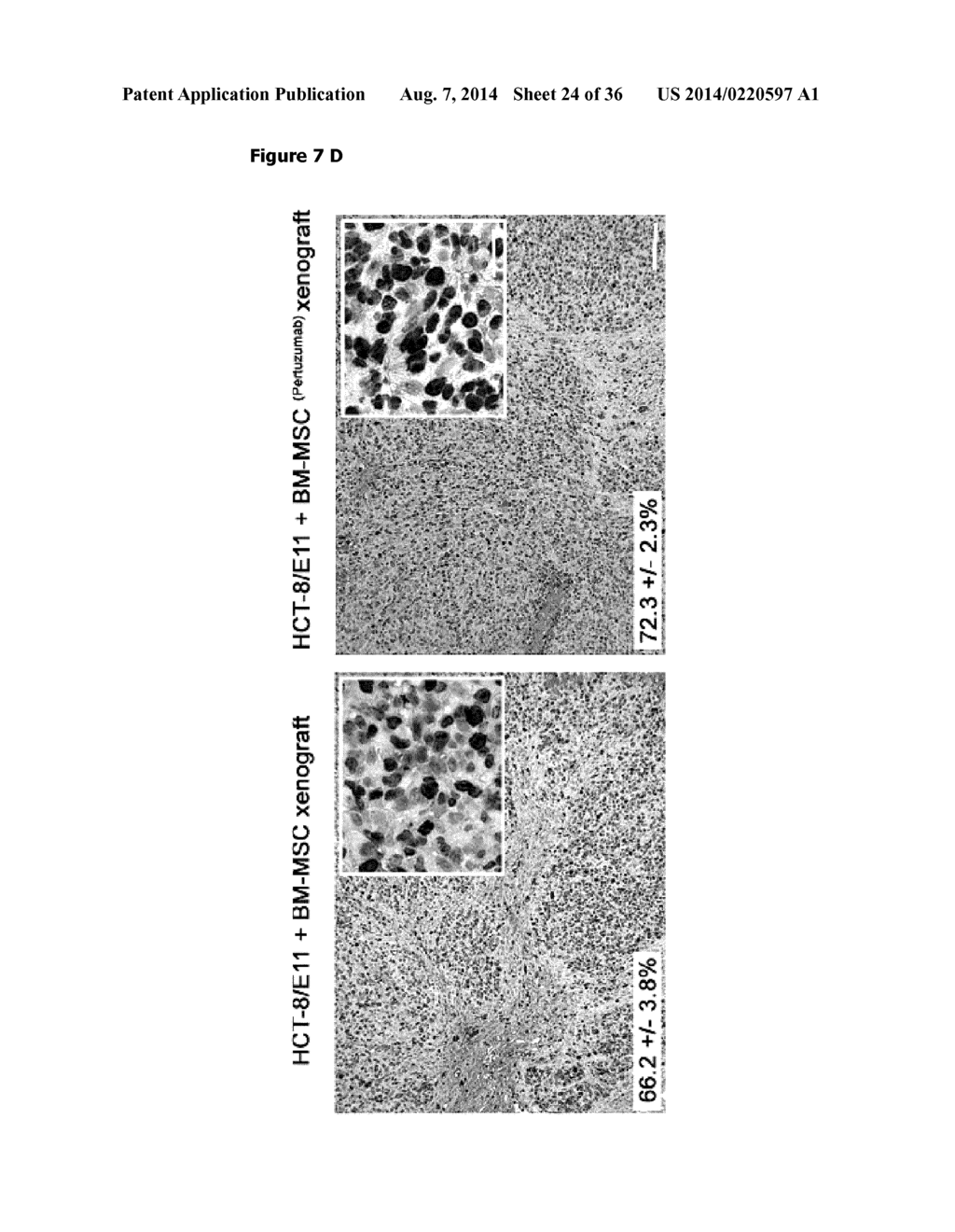 NEUREGULIN-1-BASED PROGNOSIS AND THERAPEUTIC STRATIFICATION OF COLORECTAL     CANCER - diagram, schematic, and image 25