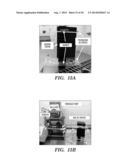 DIALYSIS LIKE THERAPEUTIC (DLT) DEVICE diagram and image