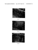 Method of Diagnosing and Therapeutically Treating a Patient for a     Traumatic Brain Injury diagram and image