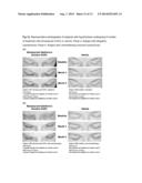 TOPICAL TREATMENT FOR CHEMOTHERAPY INDUCED EYELASH LOSS OR HYPOTRICHOSIS     USING PROSTAMIDE F2 ALPHA AGONISTS diagram and image