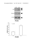 Method of Diagnosis or Prognosis of a Neoplasm Comprising Determining the     Level of Expression of a Protein in Stromal Cells Adjacent to the     Neoplasm diagram and image