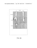 APPARATUS AND METHOD FOR ELECTROMAGNETIC TREATMENT OF NEURODEGENERATIVE     CONDITIONS diagram and image