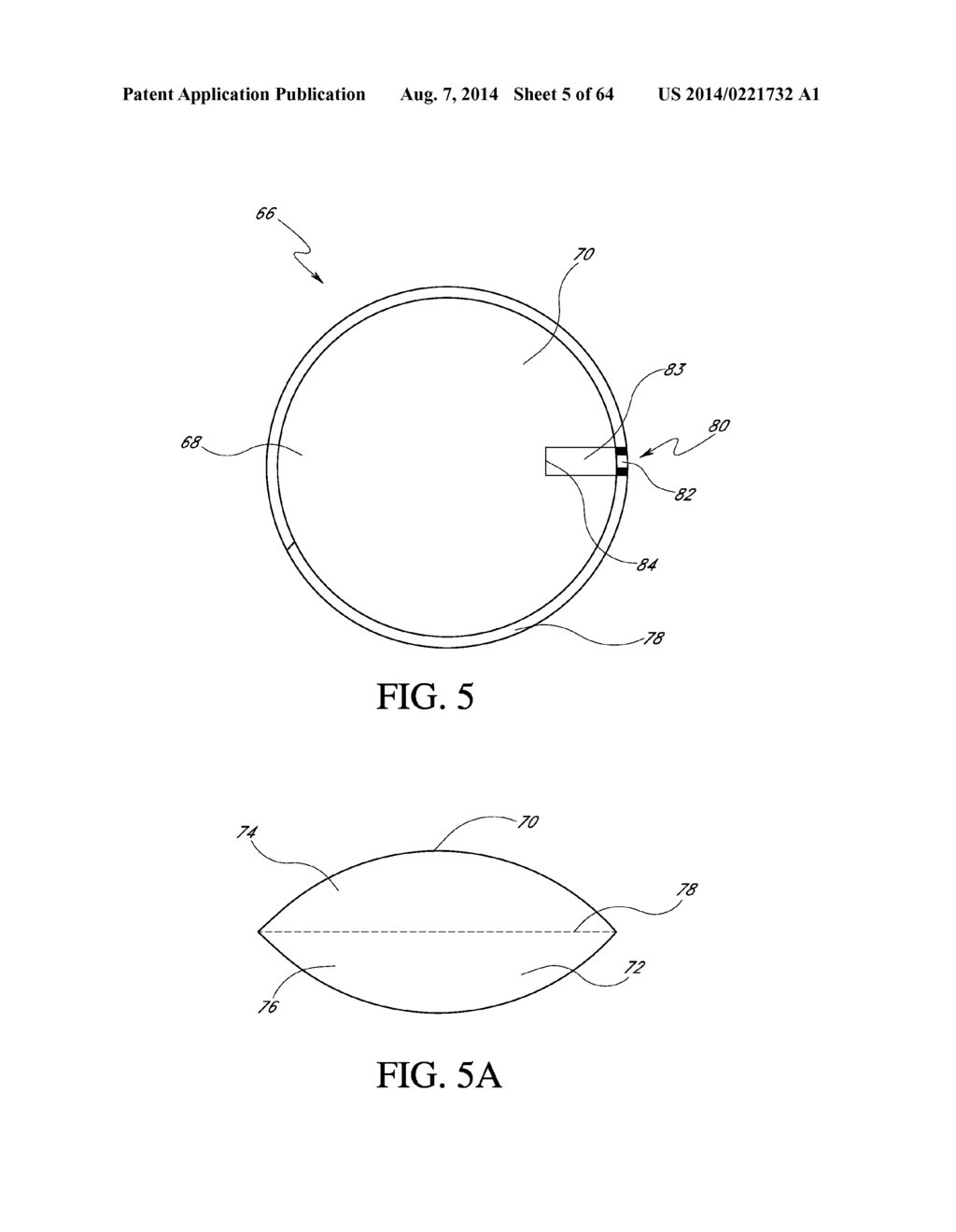 Method of removing an inflated implant - diagram, schematic, and image 06