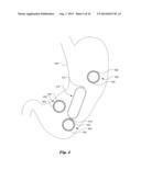 Self Assembly of In-Vivo Capsule System diagram and image