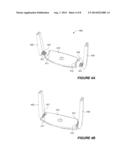 FIXATION OF DEVICE TO BACK PLATE diagram and image