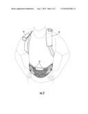 DORSAL LUMBAR EXTENSION BRACE WITH TENSIONING SYSTEM diagram and image